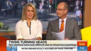 Australian TV Host Makes Unbelievable Comment To Mixed Race Twins